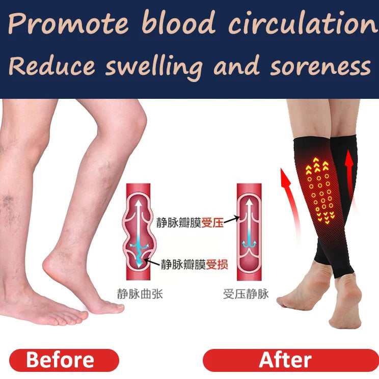 SlimFit™ Compression Socks – Unisex Calf Support for Varicose Veins, Sports & Daily Wear